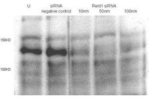 Total lysates (50 μg per lane) from Hela cells untransfected (U) or transfected with negative siRNA control or Rent1 siRNAs of 10nm, 50nm to 100nm. (RENT1/UPF1 Antikörper  (AA 583-612))