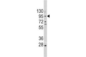 Western Blotting (WB) image for anti-Cadherin 1, Type 1, E-Cadherin (Epithelial) (CDH1) (AA 833-862) antibody (ABIN3030244)