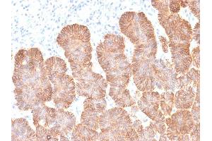 Formalin-fixed, paraffin-embedded human Skin tissue stained with EpCAM Mouse Recombinant Monoclonal Antibody (rEGP40/1372). (Rekombinanter EpCAM Antikörper  (Extracellular Domain))