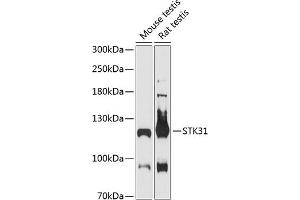 Western blot analysis of extracts of various cell lines, using STK31 antibody (ABIN6132843, ABIN6148608, ABIN6148609 and ABIN6216974) at 1:3000 dilution. (STK31 Antikörper  (AA 890-1019))