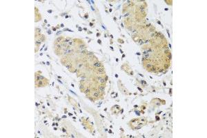 Immunohistochemistry of paraffin-embedded human stomach using IL4 antibody at dilution of 1:100 (40x lens). (IL-4 Antikörper)