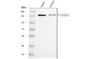 Western blot analysis of Lipin 1/LPIN1 using anti-Lipin 1/LPIN1 antibody (ABIN7602648).