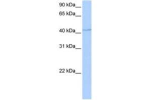 Western Blotting (WB) image for anti-DPH1 Homolog (DPH1) antibody (ABIN2463486) (DPH1 Antikörper)