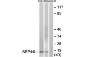 Western blot analysis of extracts from COLO/HeLa cells, using BRP44L Antibody.