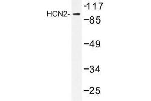 Image no. 1 for anti-Hyperpolarization Activated Cyclic Nucleotide-Gated Potassium Channel 2 (HCN2) antibody (ABIN317931) (HCN2 Antikörper)