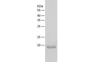 Western Blotting (WB) image for Adenylate Cyclase Activating Polypeptide 1 (Pituitary) (ADCYAP1) (AA 1-97) protein (His tag) (ABIN7121715)