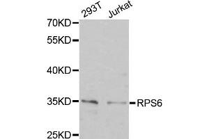 Western Blotting (WB) image for anti-Ribosomal Protein S6 (RPS6) antibody (ABIN1877085) (RPS6 Antikörper)