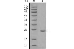 Western blot analysis using AXL mouse mAb against truncated Trx-AXL recombinant protein (1). (AXL Antikörper  (AA 466-530))