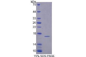 SDS-PAGE analysis of Mouse PFN4 Protein. (Profilin 4 Protein (PFN4))