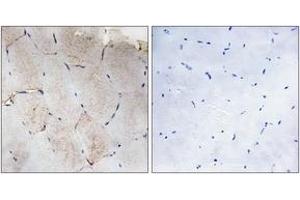 Immunohistochemistry analysis of paraffin-embedded human skeletal muscle tissue, using Collagen XII alpha1 Antibody. (COL12A1 Antikörper  (AA 1481-1530))