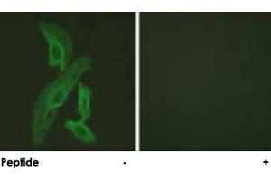Immunofluorescence analysis of HeLa cells, using BCL2L1 polyclonal antibody . (BCL2L1 Antikörper)