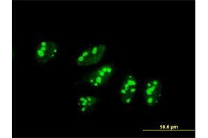 Immunofluorescence (IF) image for anti-UTP3, Small Subunit (SSU) Processome Component (UTP3) (AA 1-479) antibody (ABIN949516)