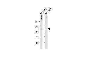All lanes : Anti-Mouse Lats2 Antibody (C-term) at 1:2000 dilution Lane 1: Mouse ovary tissue lysate Lane 2: Mouse testis tissue lysate Lysates/proteins at 20 μg per lane.