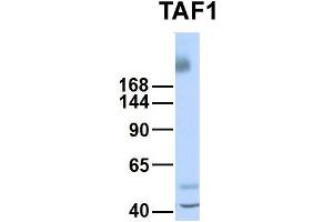 Host:  Rabbit  Target Name:  TAF1  Sample Type:  Human Fetal Liver  Antibody Dilution:  1. (TAF1 Antikörper  (Middle Region))