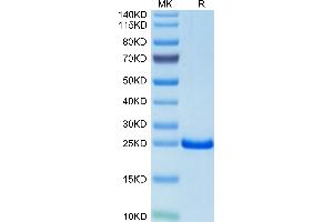 TIMP2 Protein (AA 27-220) (His tag)