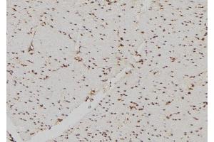 ABIN6260816 and ABIN6269226 at 1/100 staining Human gastric tissue by IHC-P. (DDIT3 Antikörper  (N-Term))
