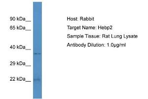 Host: Rabbit Target Name: HEBP2 Sample Tissue: Rat Lung Antibody Dilution: 1ug/ml (HEBP2 Antikörper  (N-Term))