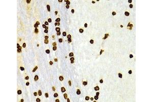 Immunohistochemistry of paraffin-embedded Rat brain using DiMethyl-Histone H3-K27 Polyclonal Antibody at dilution of 1:100 (40x lens).