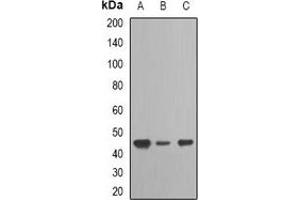 Western blot analysis of TARDBP expression in Jurkat (A), SW620 (B), A673 (C) whole cell lysates.
