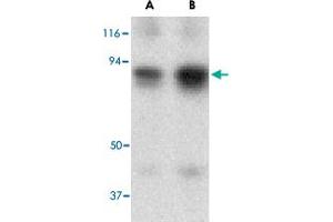 Western blot analysis of ATF6 in MDA-MB-361 cell lysate with ATF6 polyclonal antibody  at (A) 0.