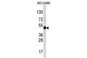 Image no. 1 for anti-Transcription Factor AP-2 alpha (Activating Enhancer Binding Protein 2 Alpha) (TFAP2A) (C-Term) antibody (ABIN357337) (TFAP2A Antikörper  (C-Term))