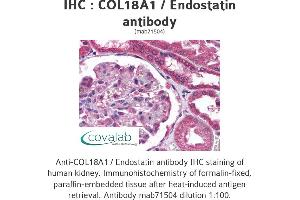 Image no. 1 for anti-Collagen, Type XVIII, alpha 1 (COL18A1) (full length) antibody (ABIN1724517) (COL18A1 Antikörper  (full length))