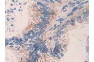 Immunohistochemistry (IHC) image for anti-Matrix Metallopeptidase 24 (Membrane-inserted) (MMP24) (AA 429-642) antibody (ABIN7441787)