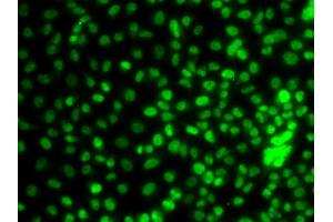 Immunofluorescence analysis of A549 cells using KLF9 antibody (ABIN5974329). (KLF9 Antikörper)