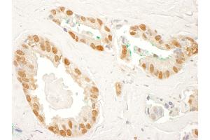 Immunohistochemistry (IHC) image for anti-RAD23 Homolog B (RAD23B) (AA 125-175) antibody (ABIN7454444)