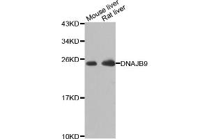 Western blot analysis of extracts of various cell lines, using DNAJB9 antibody (ABIN5975572) at 1/1000 dilution.
