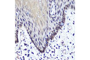 Immunohistochemistry of paraffin-embedded Human esophageal using TKT antibody (ABIN6128870, ABIN6149201, ABIN6149203 and ABIN6221921) at dilution of 1:100 (40x lens). (TKT Antikörper  (AA 1-280))