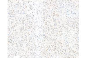 Immunohistochemistry (IHC) image for anti-Jun Dimerization Protein 2 (JDP2) (AA 50-100) antibody (ABIN7795636) (Rekombinanter JDP2 Antikörper  (AA 50-100))
