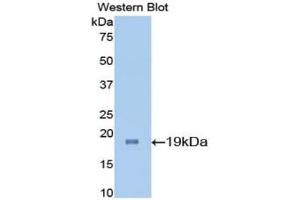 Western blot analysis of the recombinant protein. (IL-7 Antikörper  (AA 26-154))