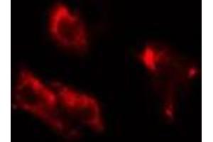 ABIN6275757 staining HuvEC cells by IF/ICC. (DGKB Antikörper  (C-Term))
