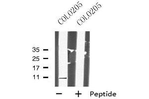 Western blot analysis of DAP using COLO205 whole cell lysates (DAP Antikörper  (N-Term))
