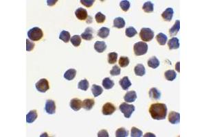 Immunocytochemistry of Acinus in K562 cells with AP30011PU-N Acinus antibody at 0. (ACIN1 Antikörper  (C-Term))