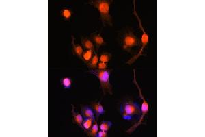 Immunofluorescence analysis of U-251 MG cells using PGP9. (UCHL1 Antikörper  (AA 59-223))