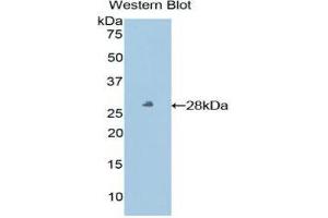 Western Blotting (WB) image for anti-HLA Class I Histocompatibility Antigen, alpha Chain E (HLA-E) (AA 22-358) antibody (ABIN1859818) (HLA-E Antikörper  (AA 22-358))