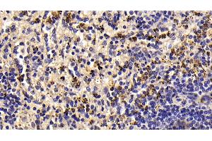 Detection of LTbR in Human Spleen Tissue using Monoclonal Antibody to Lymphotoxin Beta Receptor (LTbR) (LTBR Antikörper  (AA 66-215))