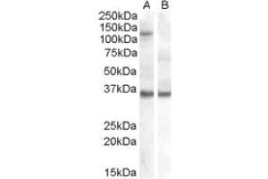 Image no. 1 for anti-Eukaryotic Translation Initiation Factor 2C, 1 (EIF2C1) (Internal Region) antibody (ABIN374655)