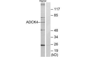 Western Blotting (WB) image for anti-AarF Domain Containing Kinase 4 (ADCK4) (N-Term) antibody (ABIN1849898) (ADCK4 Antikörper  (N-Term))