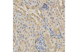 Immunohistochemistry of paraffin-embedded mouse kidney using ADD1 antibody at dilution of 1:200 (x400 lens) (alpha Adducin Antikörper  (AA 60-300))