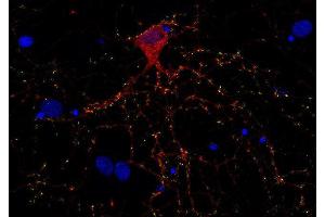 Indirect immunostaining of PFA fixed rat hippocampus neurons with anti-Complexin 1/2 (dilution 1 : 500; red) and mouse anti-synapsin 1 (, dilution 1 : 1000; green). (Complexin 1, 2 (AA 122-134) Antikörper)