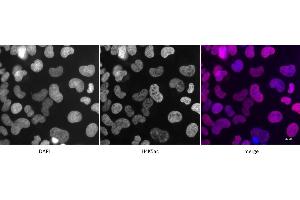 Detection of H4K5ac by immunofluorescence. (Histone H4 Antikörper  (acLys5))