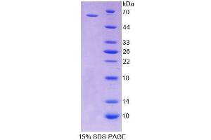 SDS-PAGE analysis of Rat CD19 Protein. (CD19 Protein)