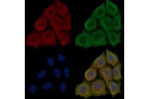 ABIN6257397 and ABIN6276107 staining Hela cells(30 min of UV treatment) by IF/ICC. (Mu Opioid Receptor 1 Antikörper  (C-Term))