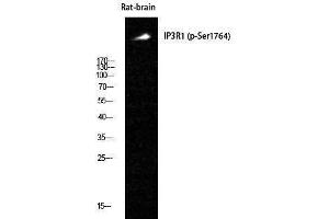 Western Blotting (WB) image for anti-Inositol 1,4,5-Trisphosphate Receptor, Type 1 (ITPR1) (pSer1764) antibody (ABIN3180459) (ITPR1 Antikörper  (pSer1764))
