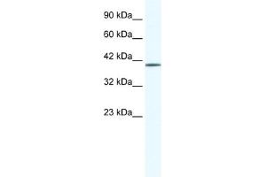 WB Suggested Anti-ZNF322A Antibody Titration:  0. (ZNF322A Antikörper  (N-Term))