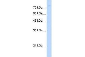 WB Suggested Anti-ZNF709 Antibody Titration:  1. (ZNF709 Antikörper  (N-Term))