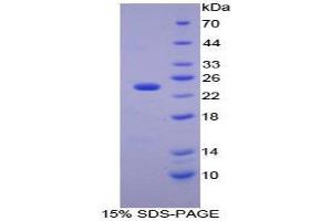 SDS-PAGE (SDS) image for Carbonic Anhydrase I (CA1) (AA 15-223) protein (His tag) (ABIN1525373) (CA1 Protein (AA 15-223) (His tag))